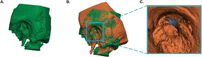 Endoscopic vs. microscopic stapes surgery: An anatomical feasibility study
